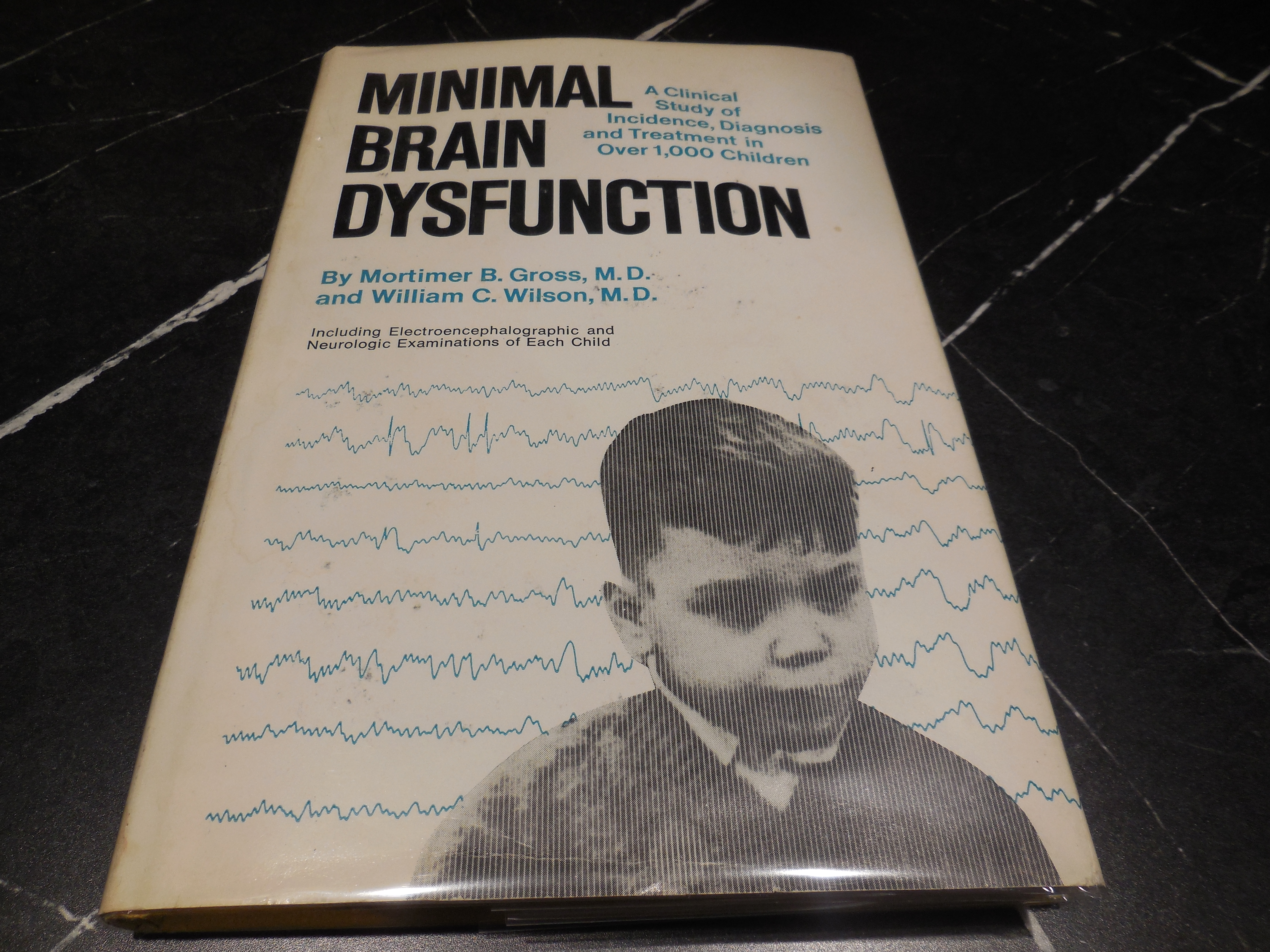 Minimal Brain Dysfunction - A Clinical Study of Indicence, Diagnosis and Treatment in Over 1,000 Children